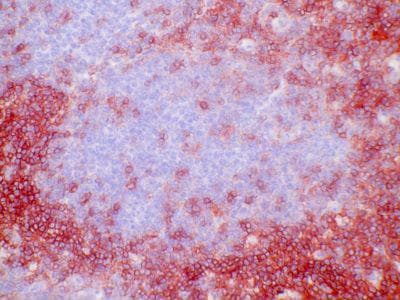 CD4 Antibody (clone EDU-2)