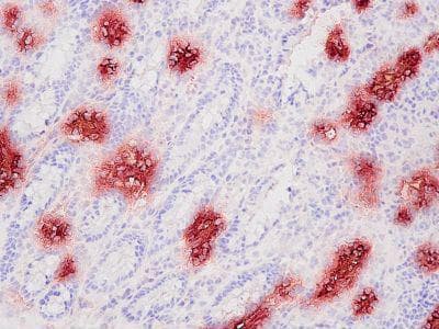 Monoclonal Mouse anti-Porcine HBB / Hemoglobin Beta Antibody (clone PLA114, IHC, WB)