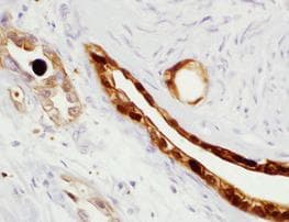 Monoclonal Mouse anti-Human S100P Antibody (clone 16/f5, Concentrated, IHC)