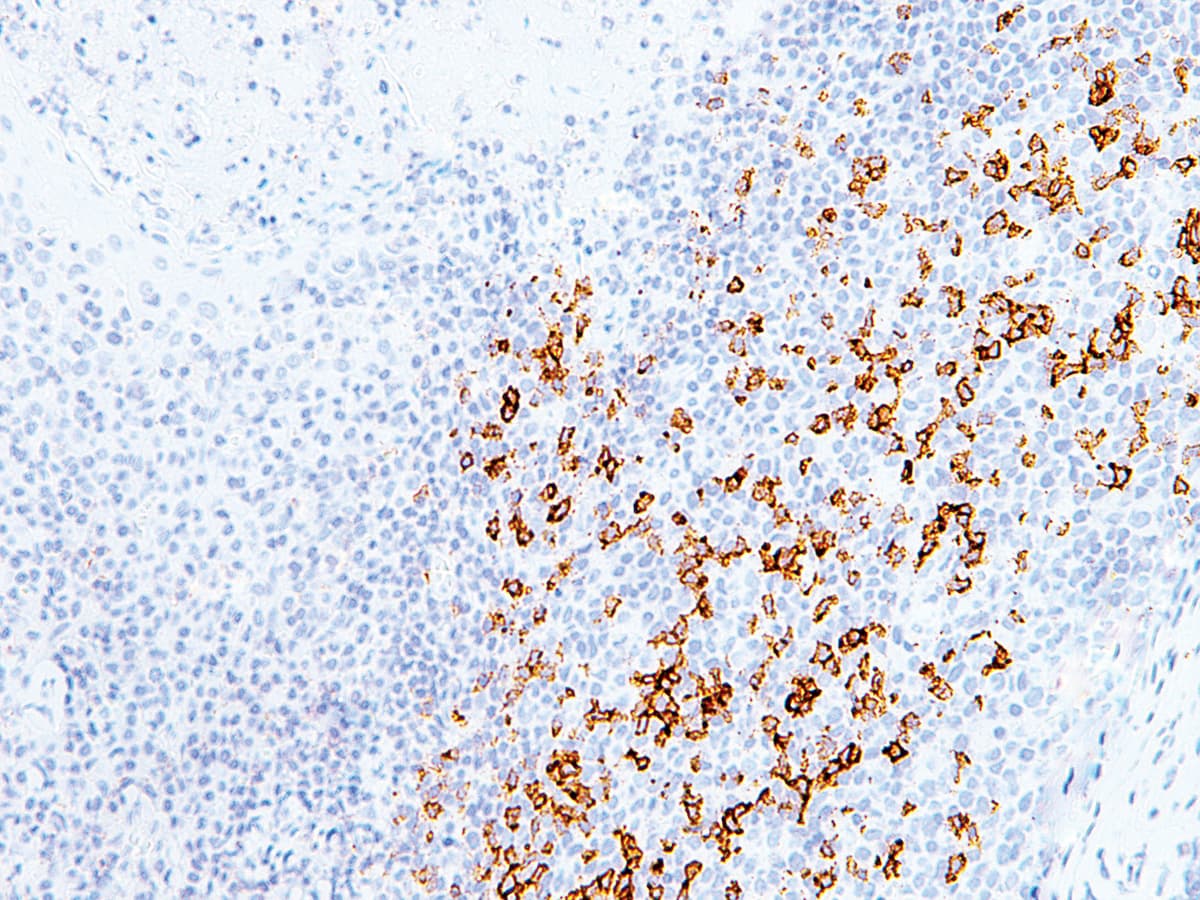 PDCD1 / CD279 / PD-1 Antibody (Ready-to-Use)