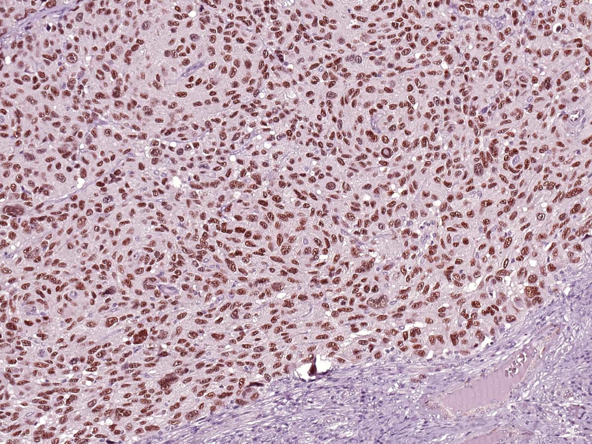 Monoclonal Mouse anti-Human SOX10 Antibody (Ready-to-Use, IHC)
