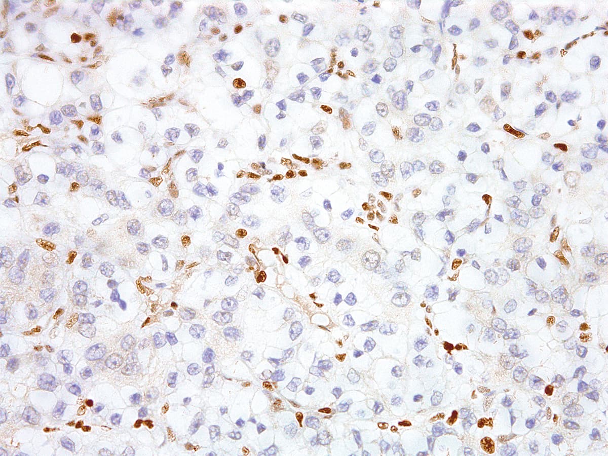 Monoclonal Mouse anti-Human TFE3 Antibody (Ready-to-Use, IHC, WB)