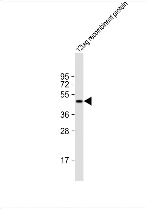His Tag Antibody (clone 6AT18)
