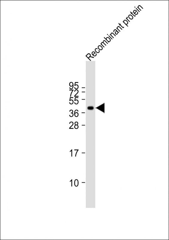 Monoclonal Mouse anti-Human FAT4 Antibody (clone 1654CT645.1.70, WB)