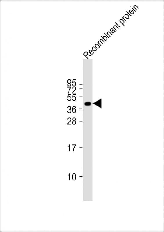 Monoclonal Mouse anti-Human FAT4 Antibody (clone 1654CT645.1.70, WB)