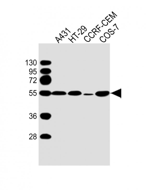 TP53 / p53 Antibody (clone 1711CT184.18.1)