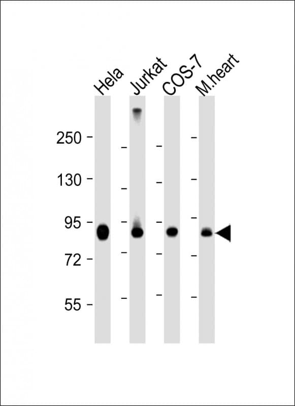 Monoclonal Mouse anti-Human PFKP Antibody (clone 1040CT4.6.4.4, C-Terminus, WB)