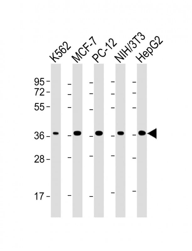 Monoclonal Mouse anti-Human EIF2S1 Antibody (clone 1763CT102.71.17, WB)