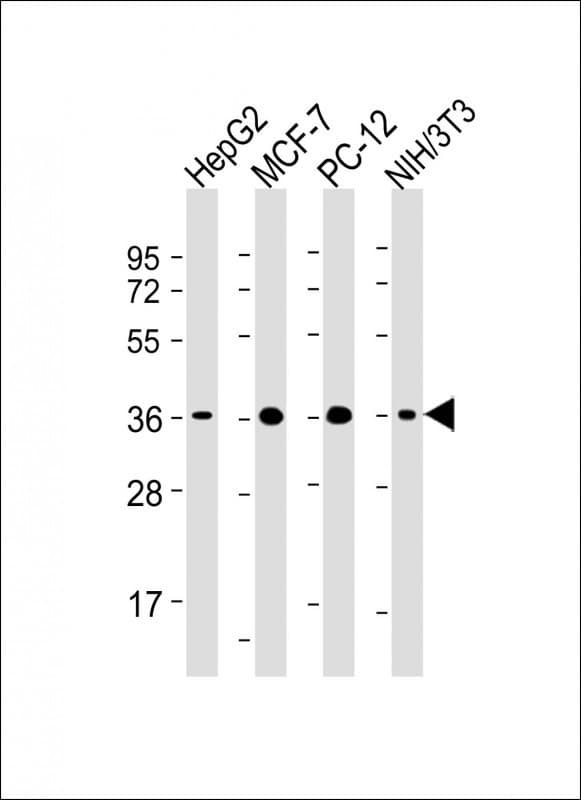 Monoclonal Mouse anti-Human EIF2S1 Antibody (clone 1763CT102.71.17, WB)