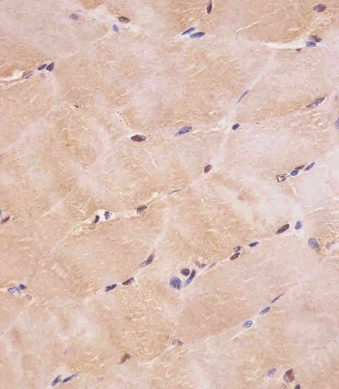 SMAD1 Antibody (clone 1356CT119.18.55)