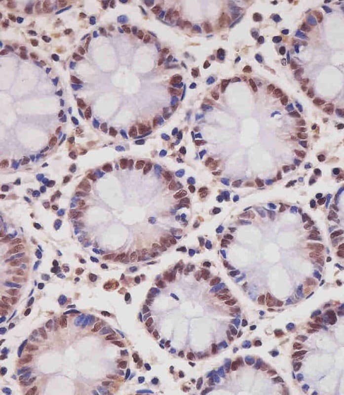 SMAD1 Antibody (clone 1356CT119.18.55)