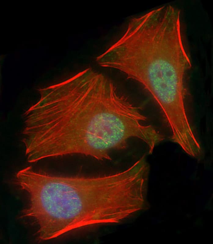 SMAD1 Antibody (clone 1356CT119.18.55)