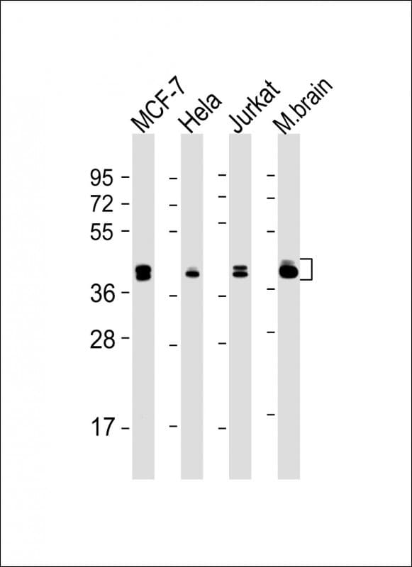 Monoclonal Mouse anti-Human MAPK3 / ERK1 Antibody (clone 1129CT3.4.3, Internal, IHC, IF, WB)