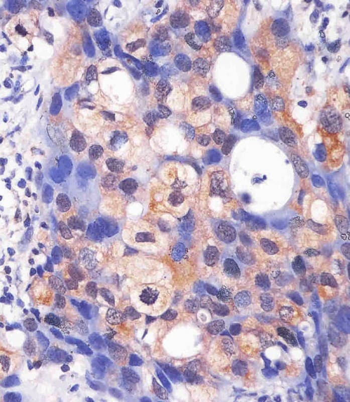 Monoclonal Mouse anti-Human MAPK3 / ERK1 Antibody (clone 1129CT3.4.3, Internal, IHC, IF, WB)
