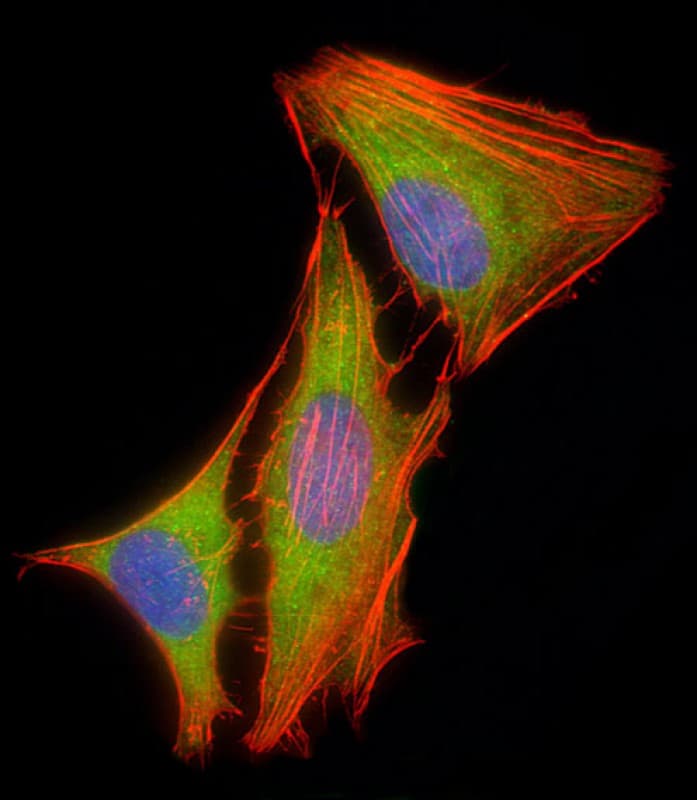 Monoclonal Mouse anti-Human MAPK3 / ERK1 Antibody (clone 1129CT3.4.3, Internal, IHC, IF, WB)