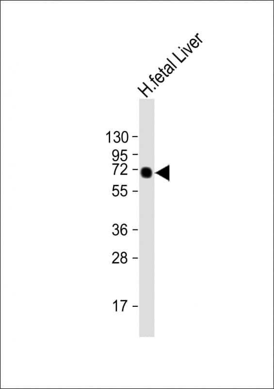 Alpha-Fetoprotein Antibody (clone 1087CT8.3.5)