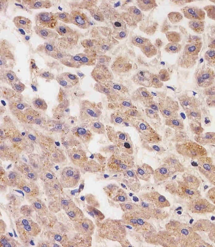 Alpha-Fetoprotein Antibody (clone 1087CT8.3.5)