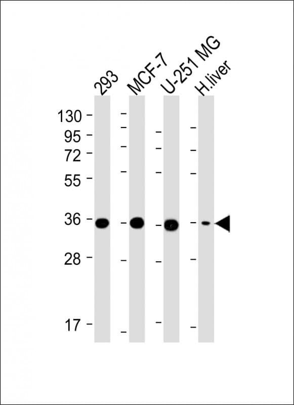Monoclonal Mouse anti-Human PDXK / PNK Antibody (clone 1007CT2.1.1, N-Terminus, IHC, WB)