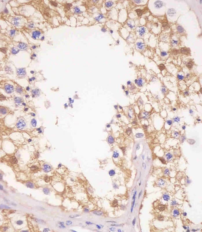 Monoclonal Mouse anti-Human PDXK / PNK Antibody (clone 1007CT2.1.1, N-Terminus, IHC, WB)