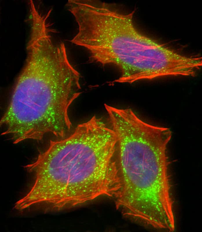 HIF1AN Antibody (C-Terminus, clone 931CT3.1.1)