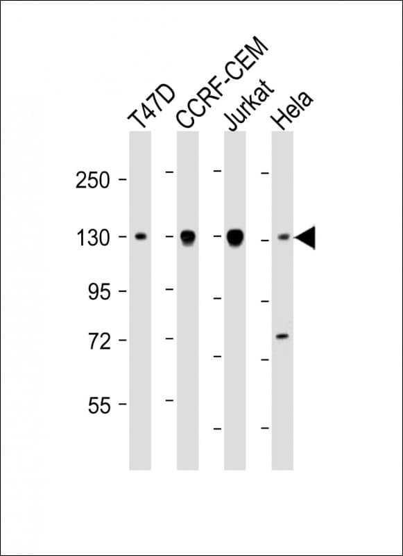 Monoclonal Mouse anti-Human DNMT3A Antibody (clone 1823CT281.43.36, WB)