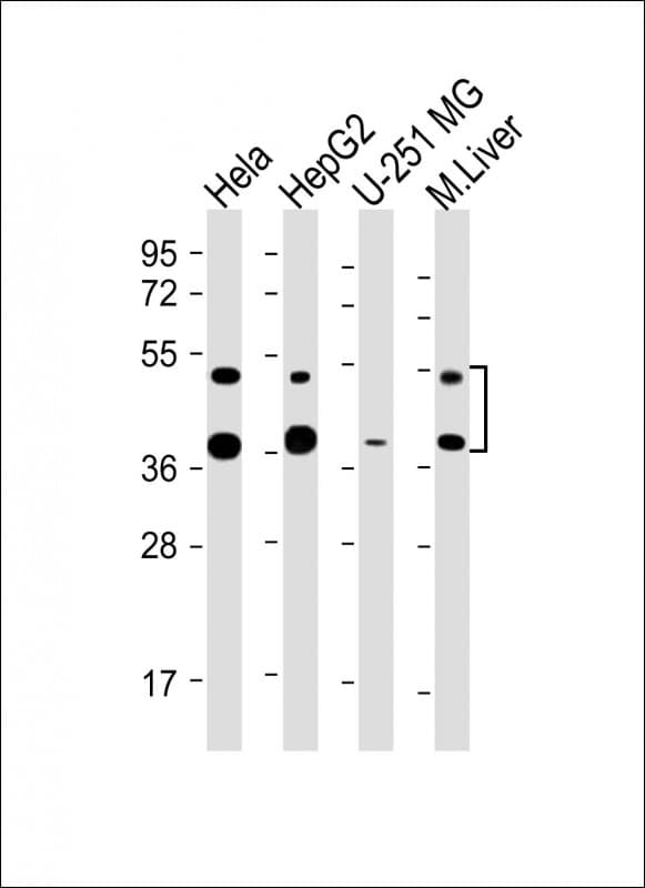 FDPS Antibody (Internal, clone 1049CT13.1.4)