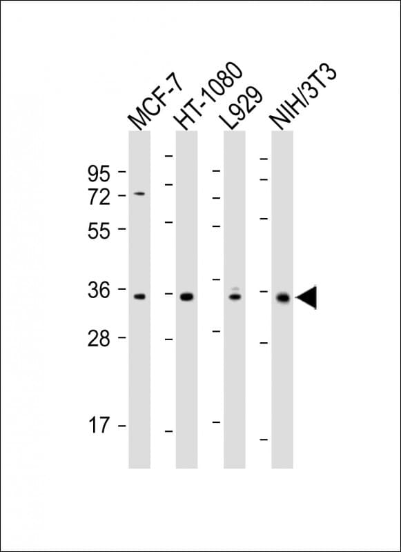 Monoclonal Mouse anti-Human CCND1 / Cyclin D1 Antibody (clone 1849CT557.93.5, WB)