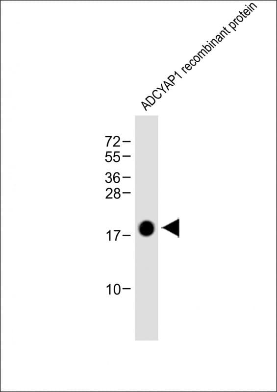 Monoclonal Mouse anti-Human PACAP Antibody (clone 1996CT329.45.62, WB)
