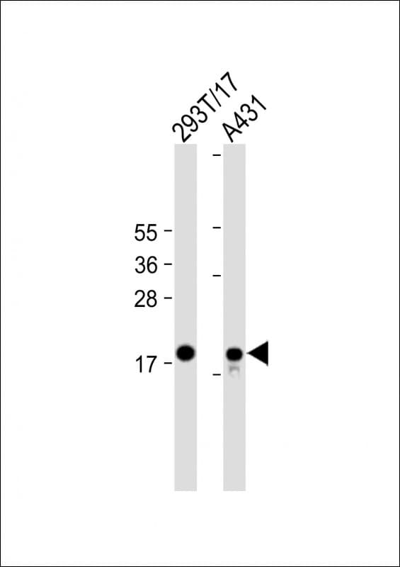 Monoclonal Mouse anti-Human UBCH10 / UBE2C Antibody (clone 2001CT211.37.61, C-Terminus, WB)