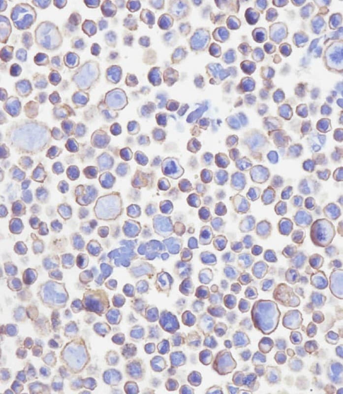 Monoclonal Mouse anti-Human CD276 / B7-H3 Antibody (clone 2009CT652.35.9, IHC, WB)
