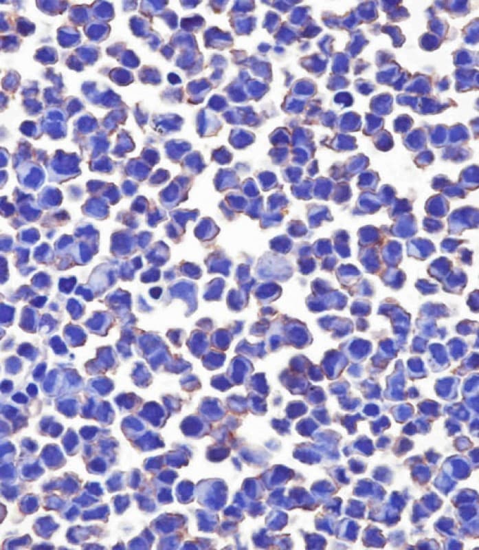 Monoclonal Mouse anti-Human CD276 / B7-H3 Antibody (clone 2009CT652.35.9, IHC, WB)