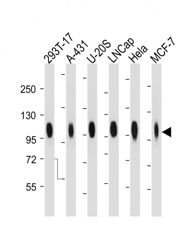 Monoclonal Mouse anti-Human CD276 / B7-H3 Antibody (clone 2009CT652.35.9, IHC, WB)