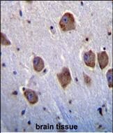 Polyclonal Rabbit anti-Human NT5DC4 Antibody (aa 172-200, Internal, IHC, WB)