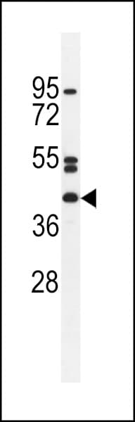 Polyclonal Rabbit anti-Human NT5DC4 Antibody (aa 172-200, Internal, IHC, WB)