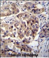 HCG1995004 Antibody (aa 116-144, Internal)