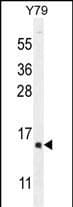 HCG1995004 Antibody (aa 116-144, Internal)