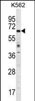 Polyclonal Rabbit anti-Human TRIM75P Antibody (aa 295-324, Internal, WB)