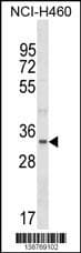 Polyclonal Rabbit anti-Human FBLL1 Antibody (aa 209-236, Internal, WB)