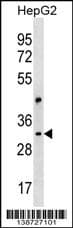 Polyclonal Rabbit anti-Human Cep170-like protein Antibody (aa 140-167, Internal, WB)