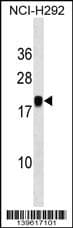 Polyclonal Rabbit anti-Human Pituitary gland-specific factor 1 Antibody (aa 26-54, Internal, WB)