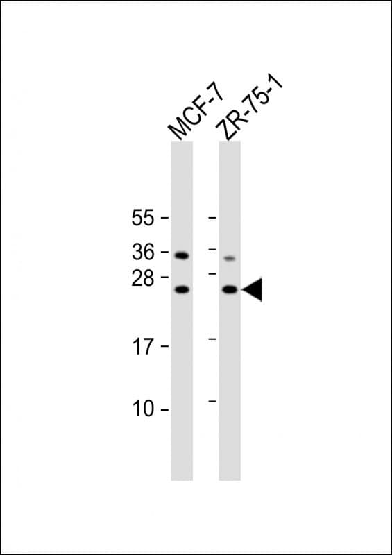 STAG3L1 Antibody (aa 108-136, Internal)