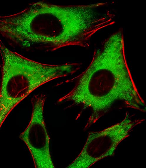 RPLP0P6 Antibody (aa 1-30, N-term)