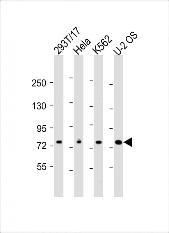 Polyclonal Rabbit anti-Human HEC1 / NDC80 Antibody (C-Terminus, WB)