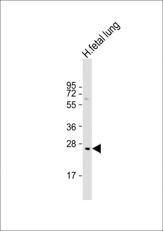 Polyclonal Rabbit anti-Human PRTN3 / Myeloblastin Antibody (C-Terminus, WB)