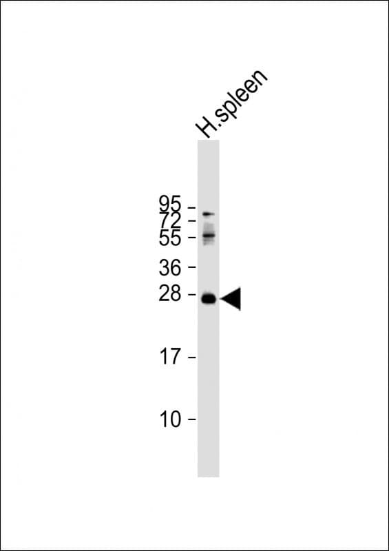 Polyclonal Rabbit anti-Human PRTN3 / Myeloblastin Antibody (C-Terminus, WB)