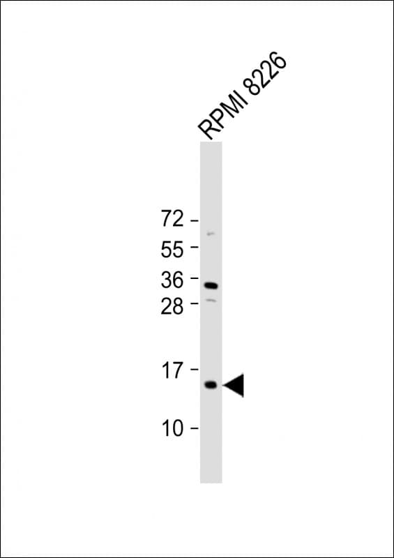 Polyclonal Rabbit anti-Human ZNRD1 Antibody (C-Terminus, WB)