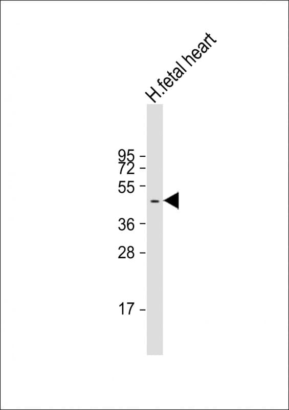 ZDHHC18 Antibody (C-Terminus)