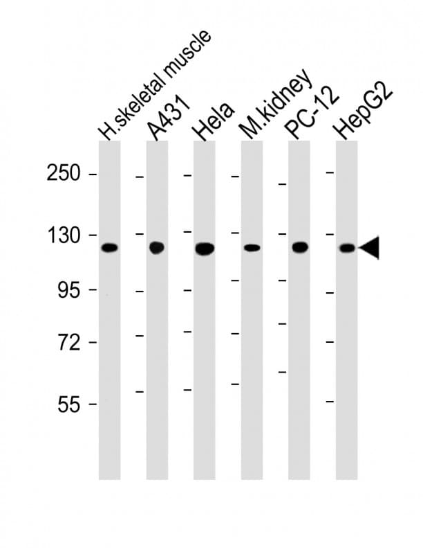 Polyclonal Rabbit anti-Human VCL / Vinculin Antibody (IHC, WB)