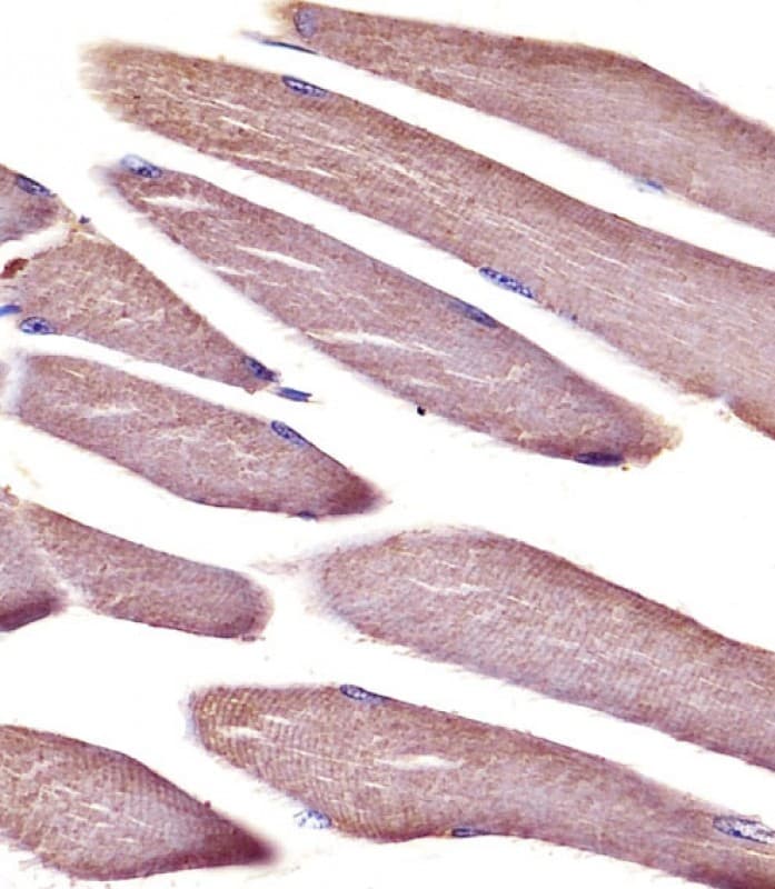 Polyclonal Rabbit anti-Human VCL / Vinculin Antibody (IHC, WB)