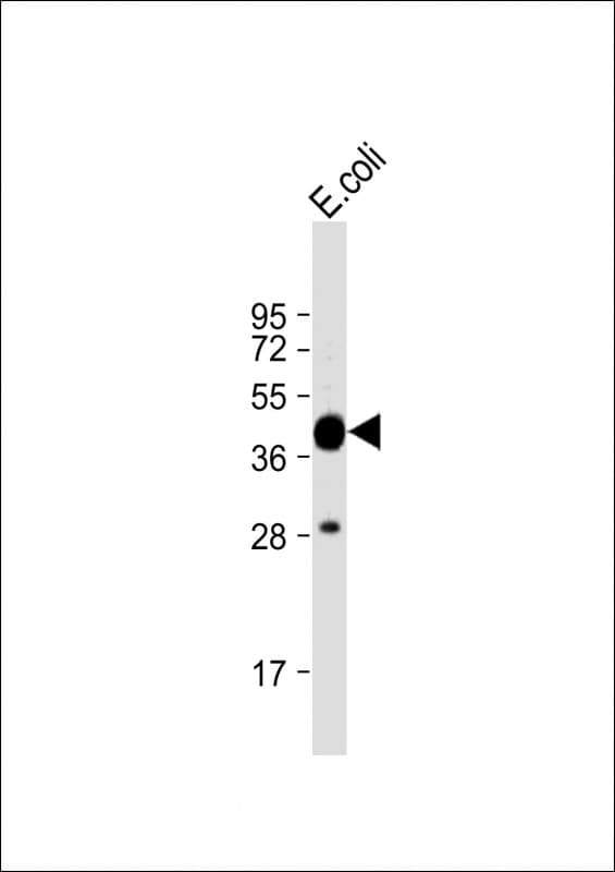 Polyclonal Rabbit MBP Tag Antibody (WB)